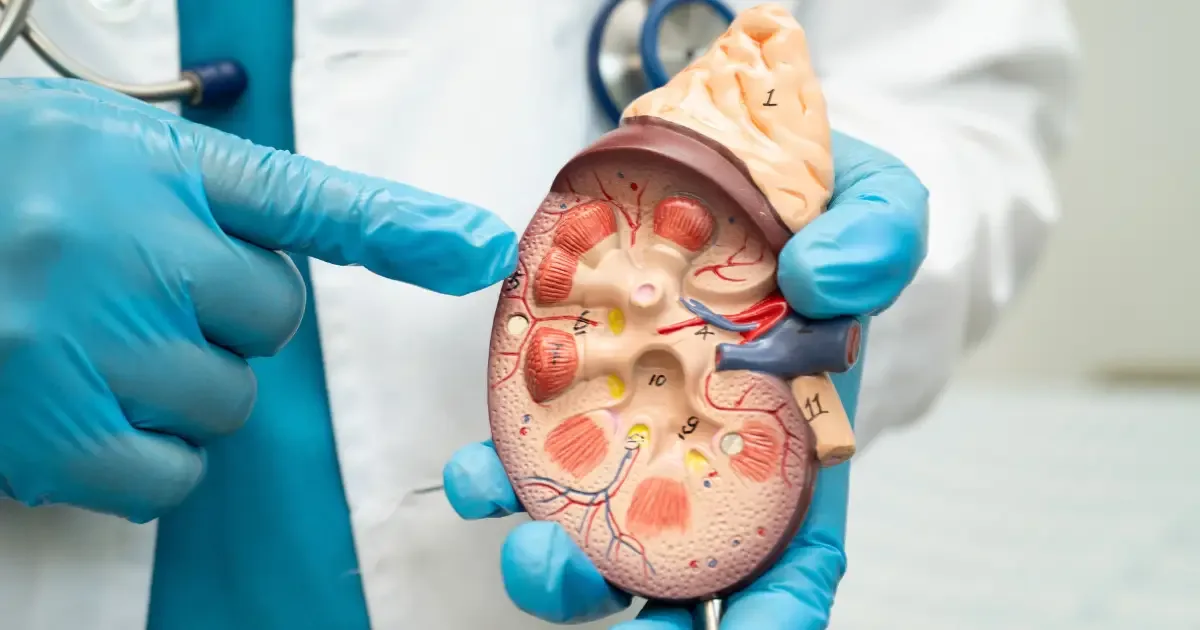 Kamen u bubregu - urolog pokazuje presek bubrega na anatomskom modelu